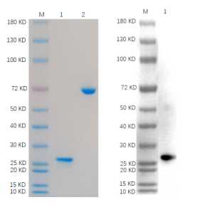 1. IGF1R: 1 μg<br />2. BSA: 1 μg